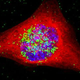 Image for article titled Trojan Horse Gold Particles Could Finally Treat Brain Tumors